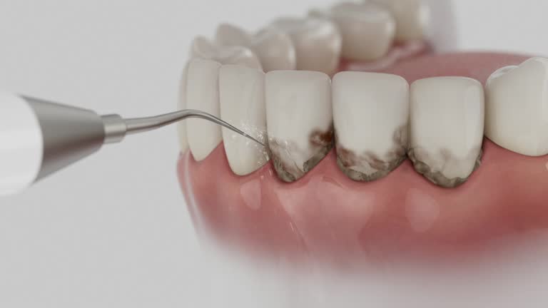 Reliable Dental Implants contractor in Fountain Valley, CA by Smile Center Dentistry